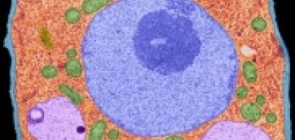 Pesquisa identifica mecanismos envolvidos na produção de óleo nas células das plantas